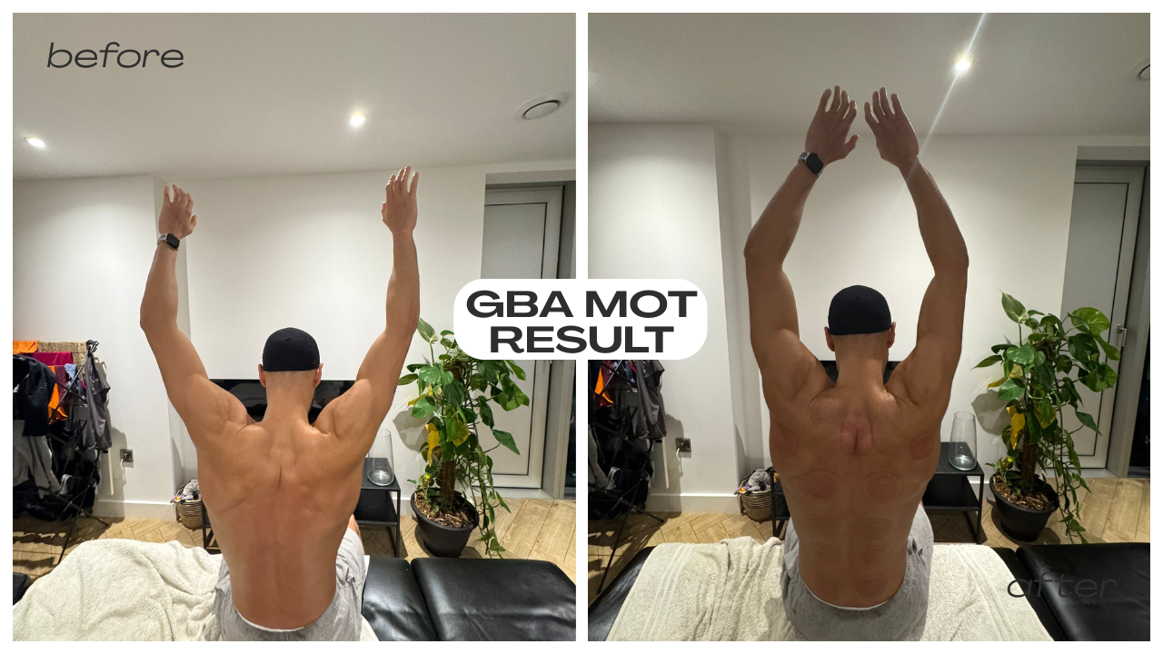 GBA MOT & Sports massage