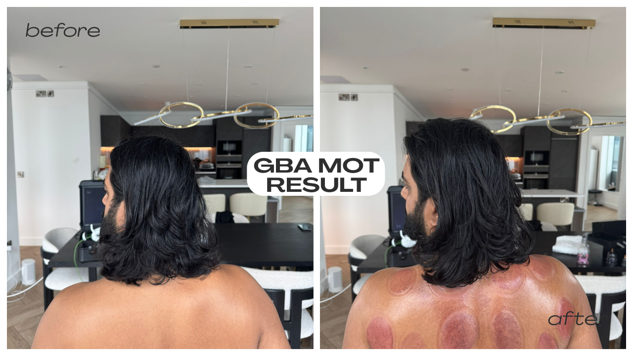 GBA MOT & Sports massage